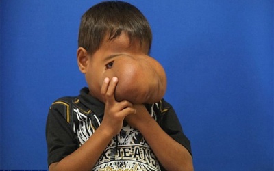 'Bàn tay vàng' cứu số phận 1 con người