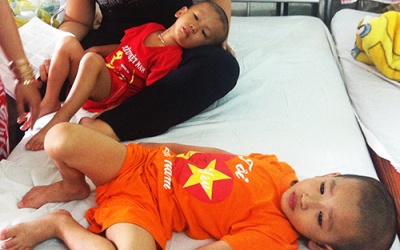 Hai anh em cùng bị viêm não do virus đường tiêu hóa