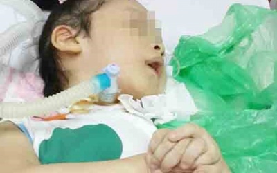 Xót xa bé gái bị teo cơ tủy sống