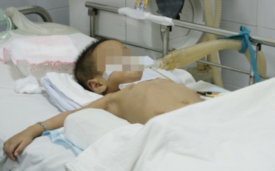 4 trẻ hôn mê vì tưởng thuốc là kẹo