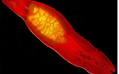 Ăn gỏi cá, người đàn ông ở Hà Nội bị sán đóng tổ trong “của quý”