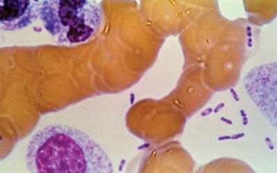 Phát hiện dịch hạch thể phổi ở Trung Quốc