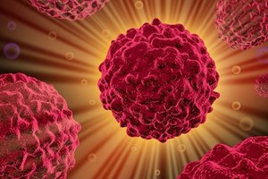 Iran: Dùng cảm biến nano chẩn đoán sớm ung thư