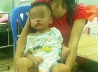 Cứu sống bé trai 2 tuổi bị thủng đại tràng