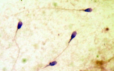 Nghiêm cấm hành vi kinh doanh, quảng cáo tinh trùng