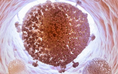 Có thể loại bỏ virus HIV khỏi tế bào người