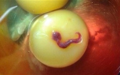 Sự thật vụ sinh vật lạ trong lòng đỏ trứng gà