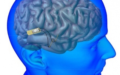 Liệu có máy phục hồi trí nhớ?