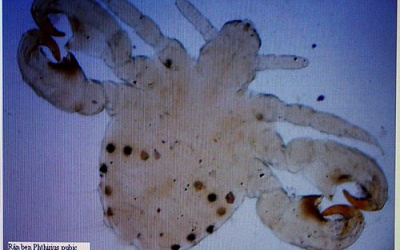 Xuất hiện nhiều trường hợp rận mu kí sinh