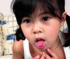 Chủ động ngăn ngừa bệnh hô hấp trong mùa mưa