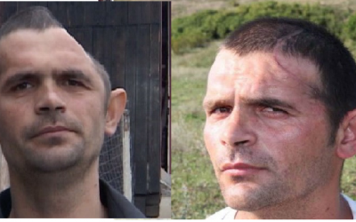 “Cấy” thành công hộp sọ cho người mất gần nửa đầu