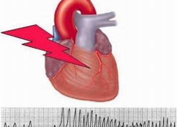 Phòng tránh biến chứng khi người cao tuổi bị sốt
