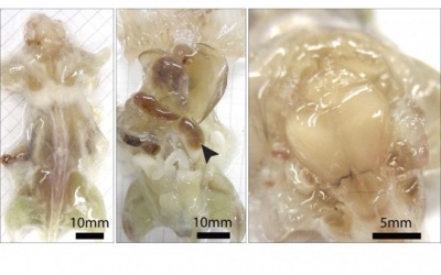 Làm trong suốt cơ thể để chữa bệnh