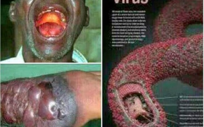 Virus Ebola ‘giết người’ như thế nào?