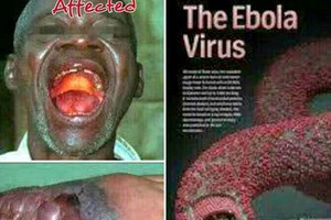 Phát hiện liều thuốc trị virus Ebola?
