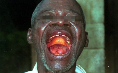 Gần một nghìn người tử vong vì Ebola