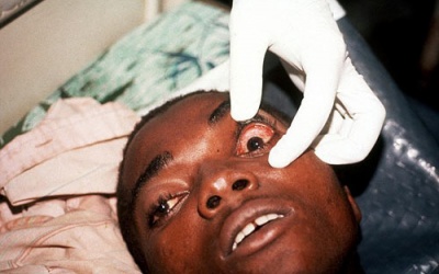 Thái Lan: 21 du khách nghi nhiễm Ebola