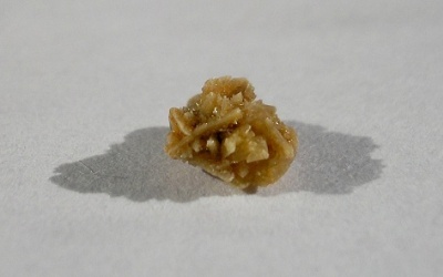 Công cụ dự báo sỏi thận tái phát