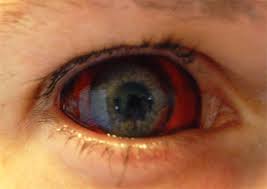 Những điều nhất định phải biết về đại dịch Ebola