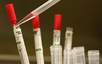 Những điều cần biết về thuốc ZMapp chữa Ebola