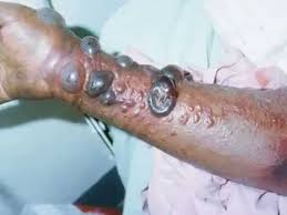 FDA: Cảnh báo nạn rao bán thuốc giả lợi dụng đại dịch Ebola