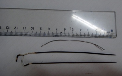 Hà Tĩnh: Phát hiện 3 thanh kim loại trong ổ bụng nam thanh niên