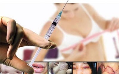 Nhiễm trùng cổ, ngực vì... tự tiêm silicone