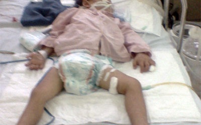 Bác sỹ chẩn đoán sai bệnh: Bé 3 tuổi nguy kịch