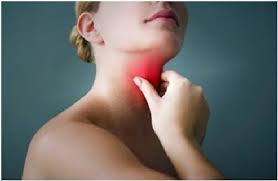 Viêm họng- những điều cần biết