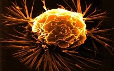 Việt Nam có hơn 200 người chết vì ung thư mỗi ngày?