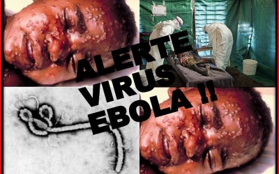 Những câu hỏi thường gặp về dịch bệnh do virus Ebola