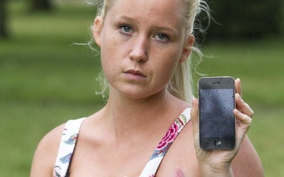 Bỏng ngực nặng do sạc iPhone phát nổ