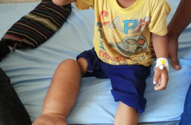 Bệnh nhi bị thắt vòng ở chân được xuất viện