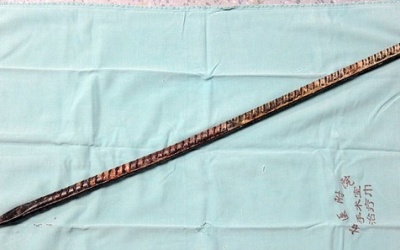 Bị thanh sắt xuyên từ trán xuống hàm vẫn sống sót