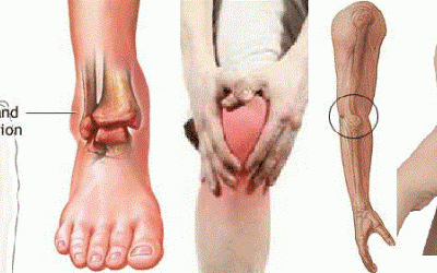 Những cơn đau lúc nửa đêm…