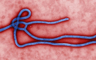 5 cách phòng bệnh Ebola hiệu quả