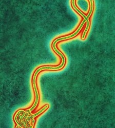 Ebola: Thử nghiệm vaccine trên người ở Mỹ