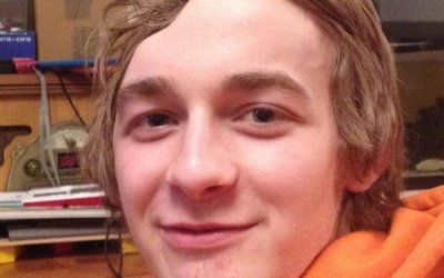 Lạ với nam thanh niên có hộp sọ bị méo