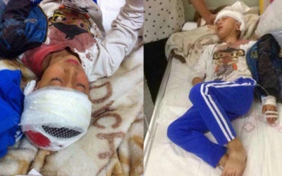 Bị thầy đánh nhập viện vì không biết vẽ