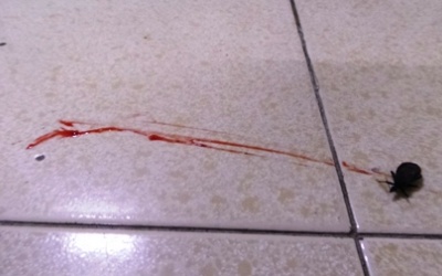 Bọ xít hút máu người tấn công bé 2 tuổi