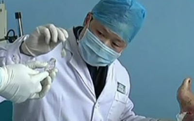 Điều trị đái tháo đường bằng giòi