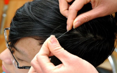 Làm gì khi tóc bạc sớm