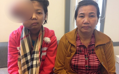 Phẫu thuật khối u trên gương mặt thiếu nữ