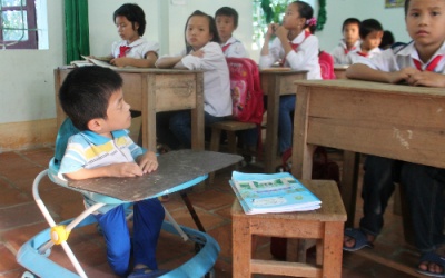 Nghị lực phi thường của cậu bé xương thủy tinh