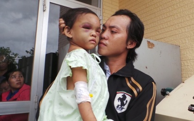 Bé 4 tuổi bị bố mẹ bạo hành đã  được xuất viện