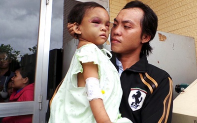 Bé gái bị bạo hành đã xuất viện, về sống với cha