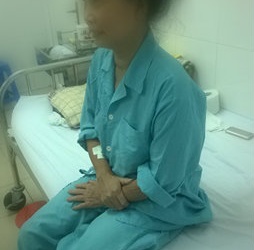 Cắt thùy trên phổi bằng phương pháp nội soi