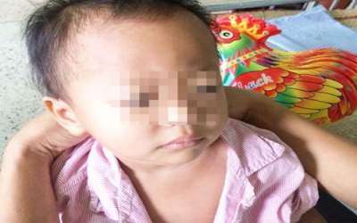 Cảnh giác khi trẻ đau bụng bất thường