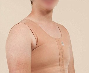 Nam thanh niên khổ sở vì vòng 1 quá cỡ