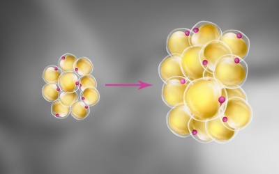 Mỡ trắng - thủ phạm gây bệnh béo phì